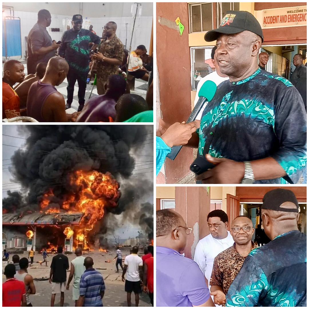 Gas Explosion: C’River Health Commissioner Visits UCTH, Says Over 60 Victims Receiving Treatment