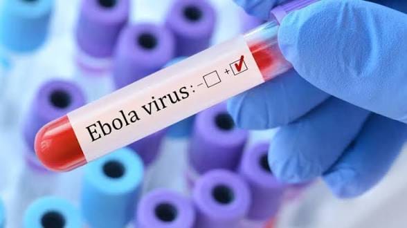 Ebola: Cross River Calls for Calm, Strict Infection Prevention Measures